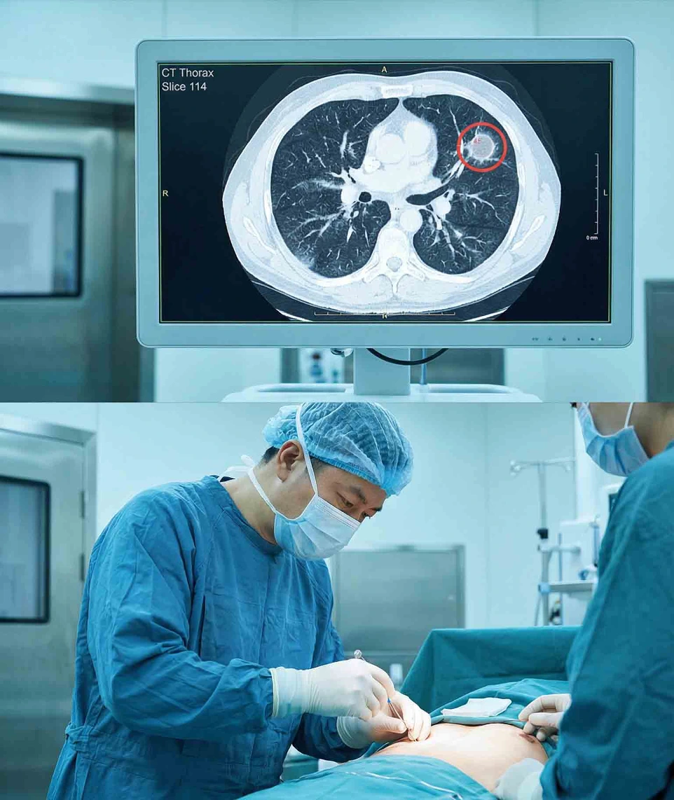 济南960医院肿瘤介入