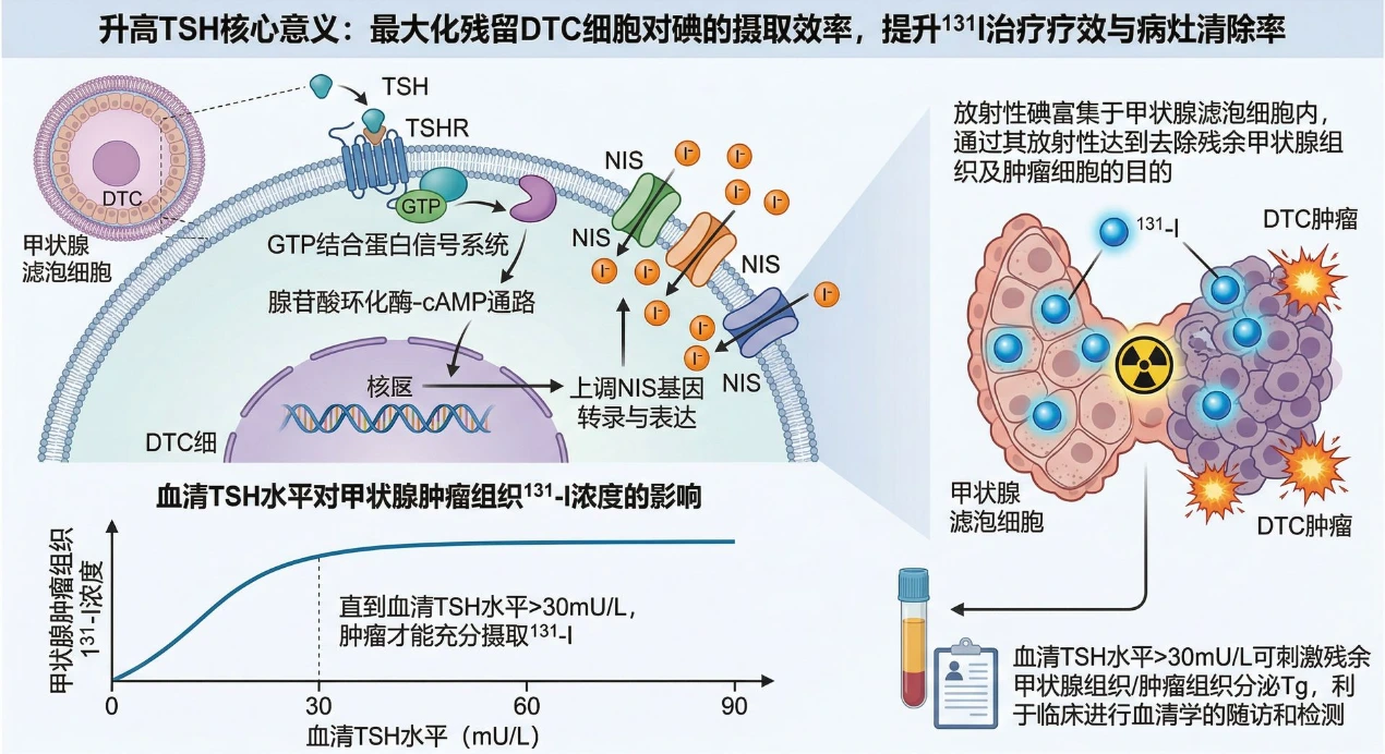 济南碘131治疗