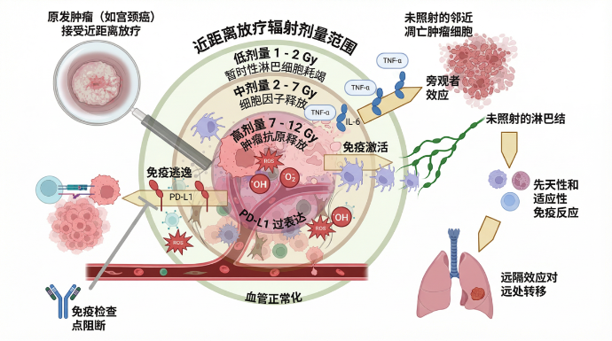 粒子植入能治哪些病？有什么优势？